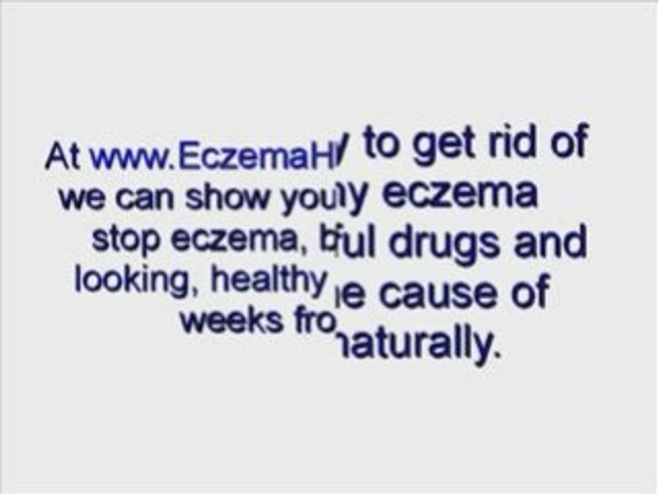 Home remedies for eczema - learn how to heal eczema forever