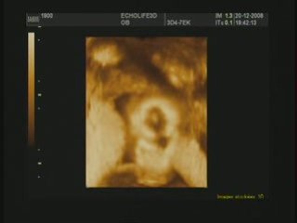 Echo3d