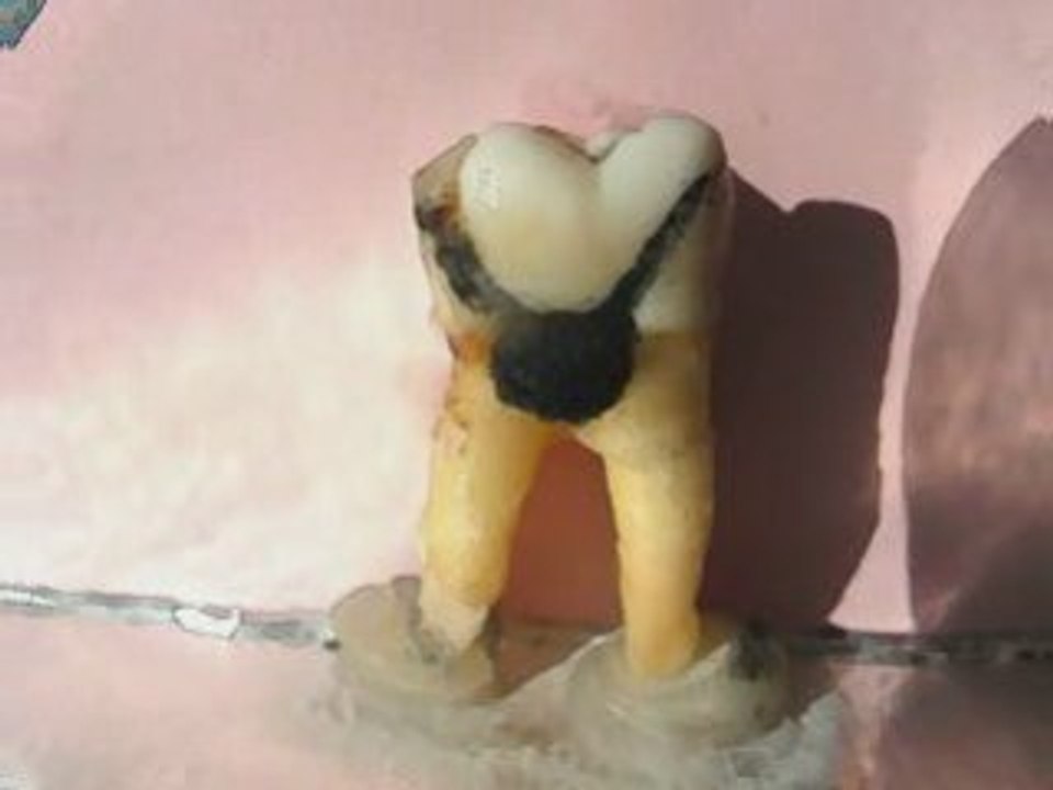 Can't get enough of your love , babe , version dentaire.