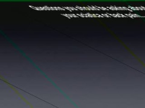 Spinal Decompression to Relieve Sciatica