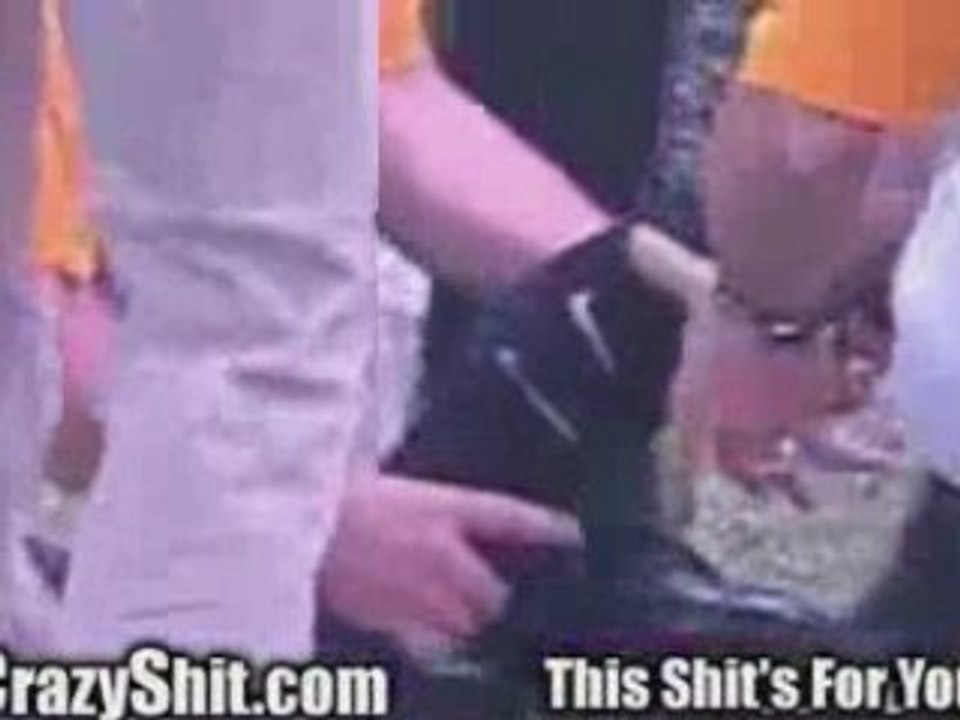 Football players leg turns to rubber