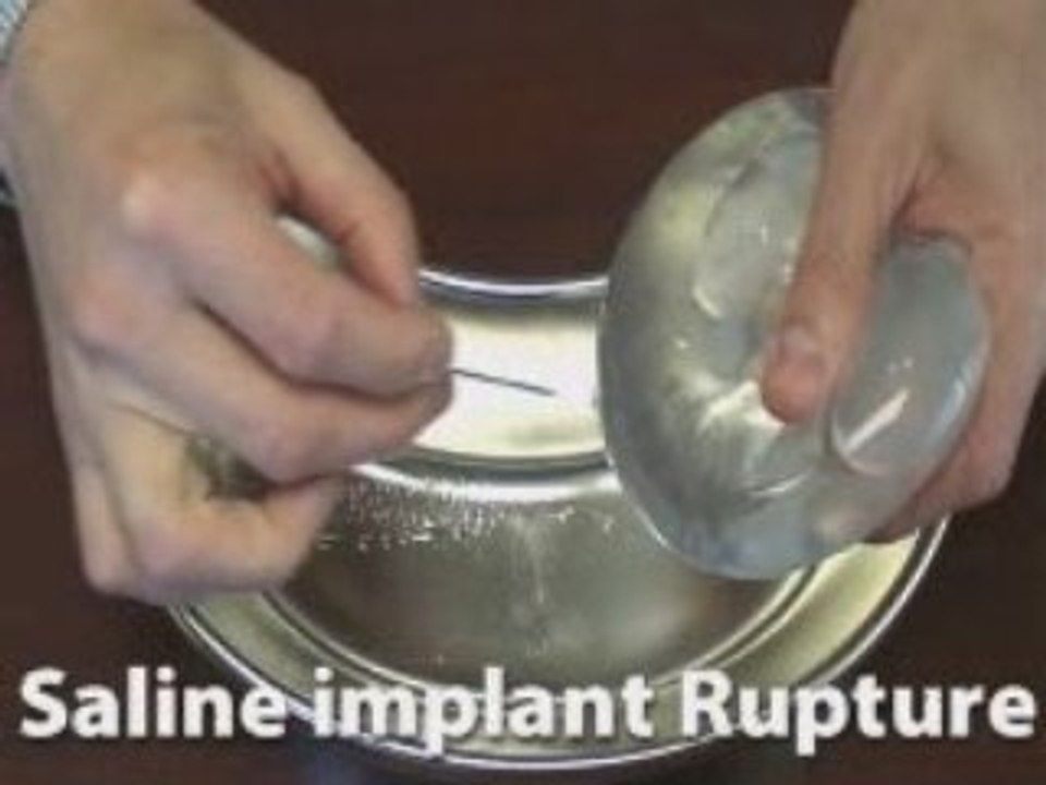 Saline vs. Gel Implants Atlanta Breast Aurmentation