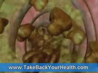 What are Proteolytic Enzymes?