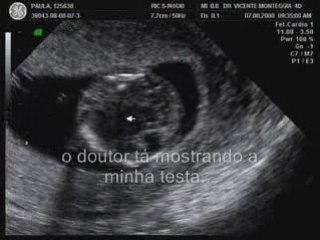 Clip da Eco do Franco_0003