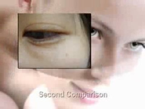 Anti-Aging Cream | Dermalastyl Report | Anti-Wrinkles