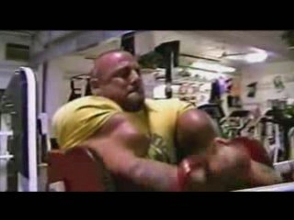 The Man Whose Arms Exploded Part 3