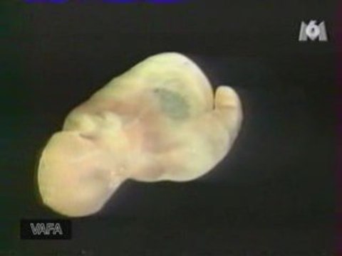 Joseph Jernigan - Visible Human Project