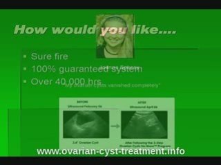 Revolutionary ovarian cyst treatment