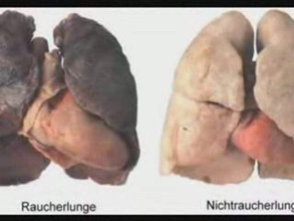 StopSmokingNow