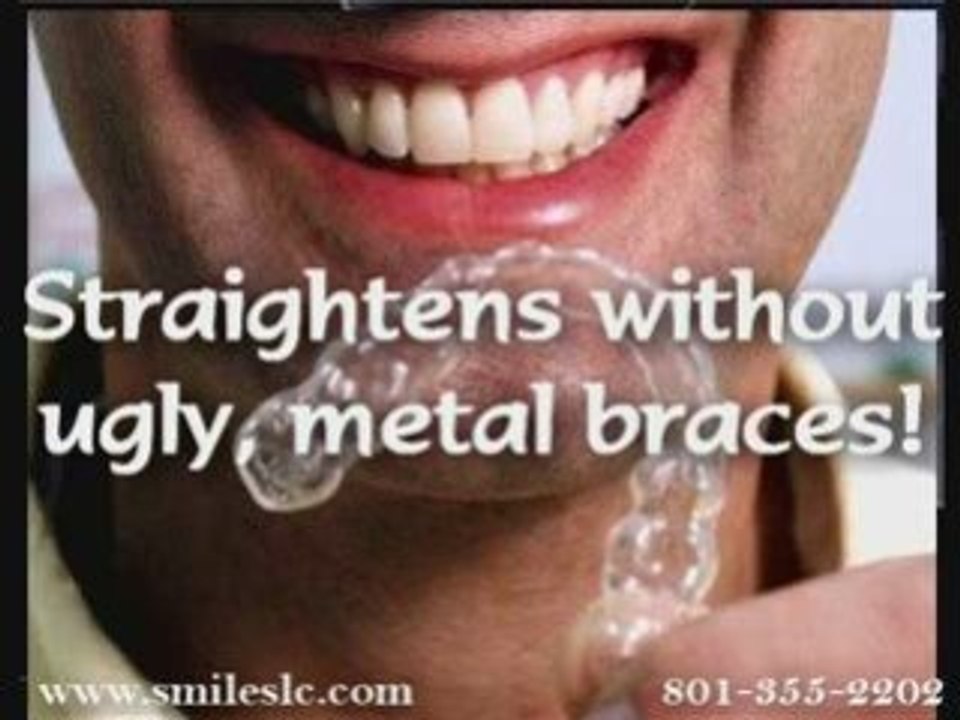 Salt Lake Dentist Dr. David L. Duke Invisalign Specialist
