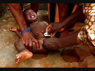 L'excision dans la Corne de l'Afrique