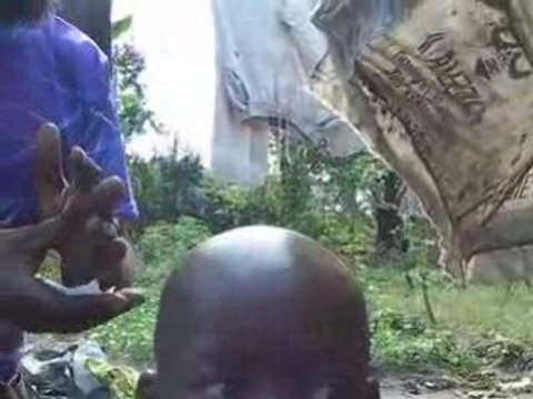 Maladies sexuellement transmissibles