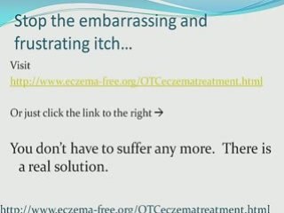 all natural non steroidal eczema treatment