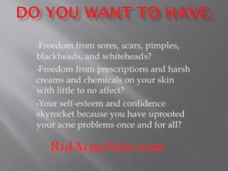 Learn Natural Ways To Get Rid of Acne