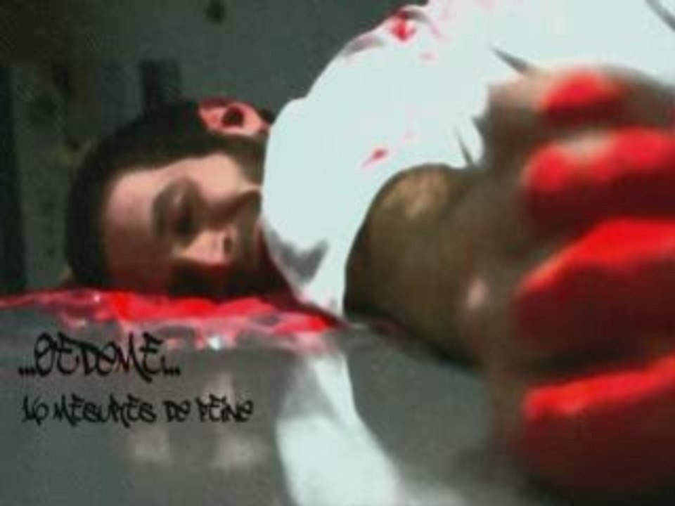 Oedème 16 mesures de peine