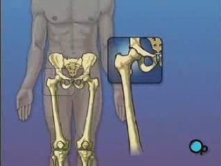 PreOp Surgery Centers