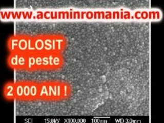 Apa cu Argint Coloidal | Antibacterian Nano Argint!