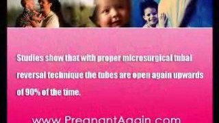 Tubal Reversal Facility, Essure Tubal Reversal, Tubaligation