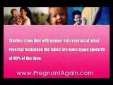 Tubal Reversal Facility, Essure Tubal Reversal, Tubaligation