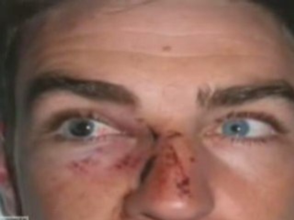 Hit in face_to_DivX_clip0
