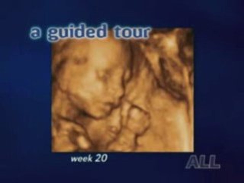 Echographie vidéo 3D du foetus