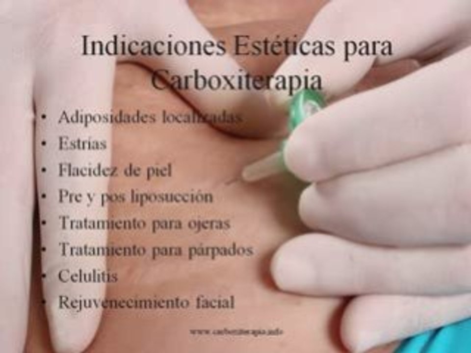 Teoria Carboxiterapia