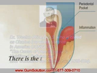 bleeding gums more condition treatment