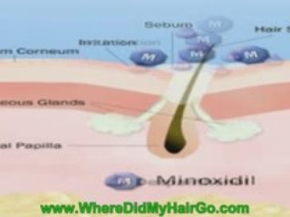 How to Make Minoxidil More Effective