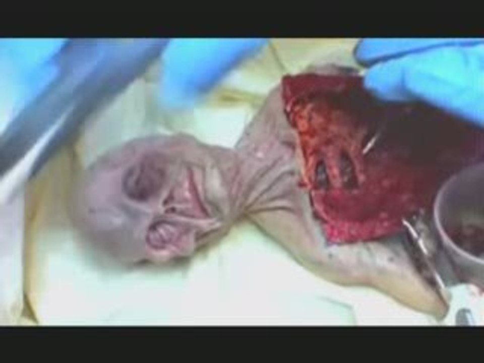 Autopsie alien