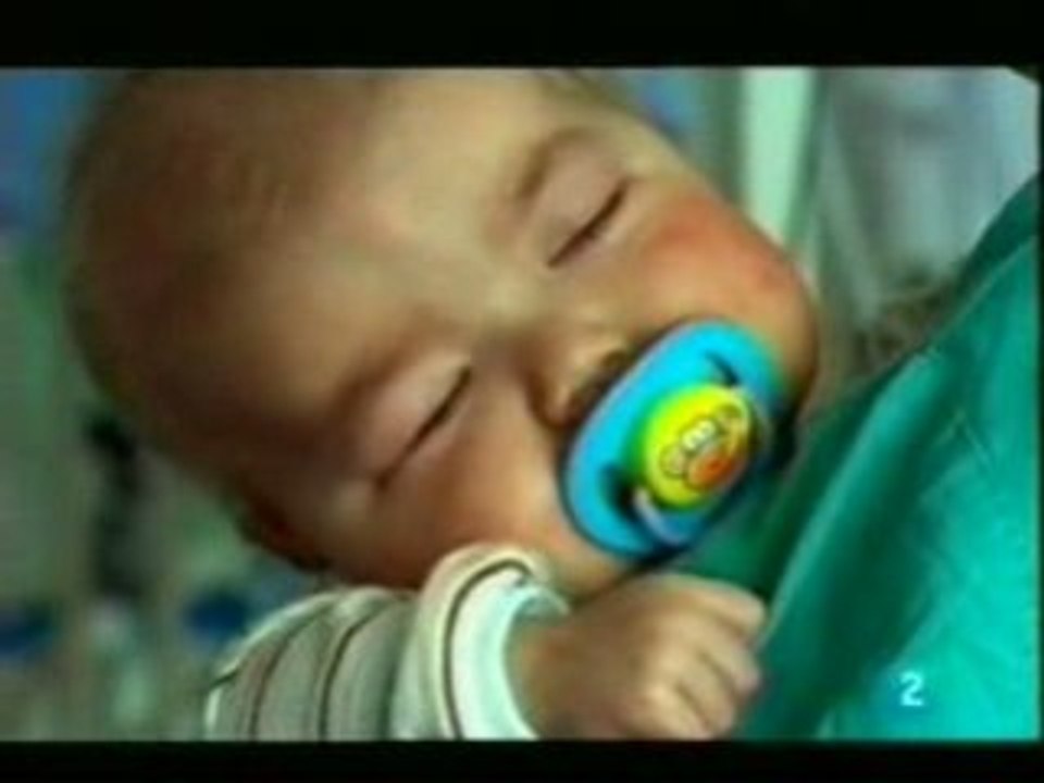 Sindrome IPEX