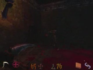 Skeletons of the undead!