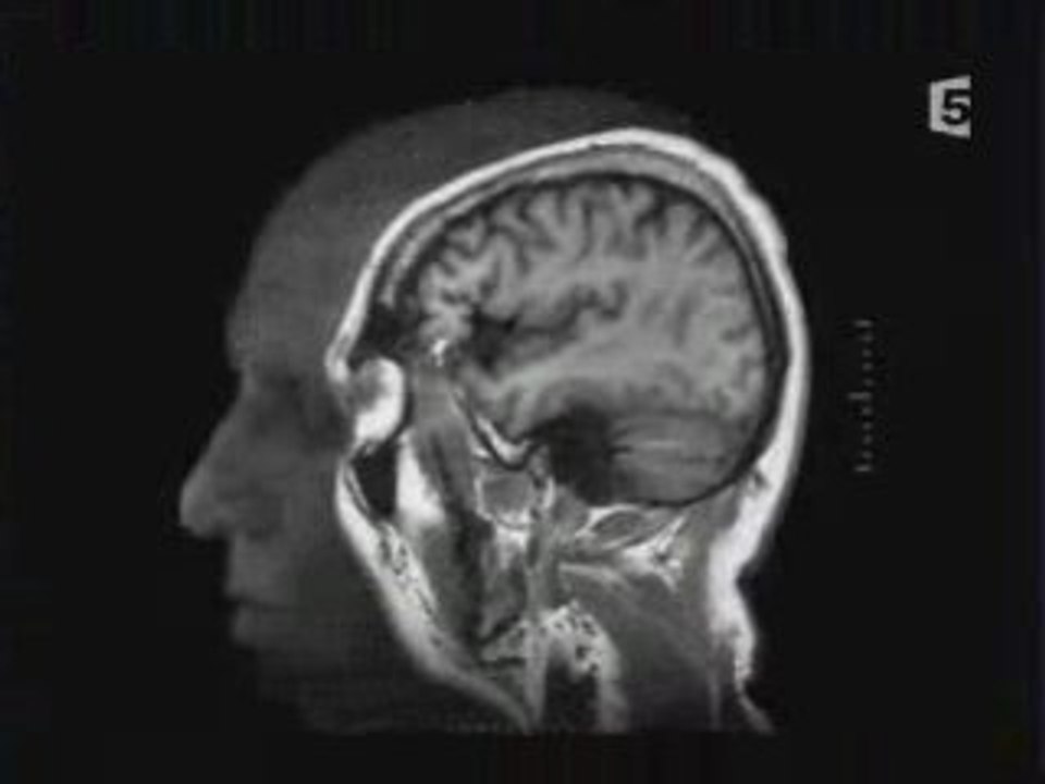 La Grande Histoire Du Cerveau 1/3