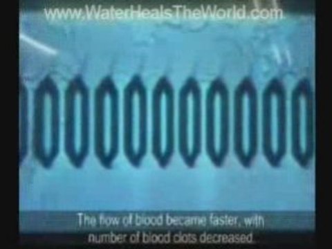 Healthy Ion Alkaline Water ph balance machine Part 5