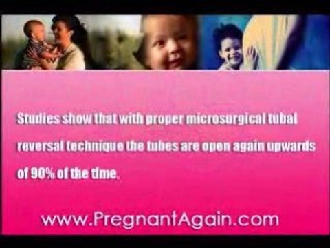 Tubal Reversal Facility, Essure Tubal Reversal, Tubaligation