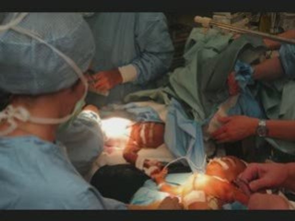 les bébés siamois malgaches