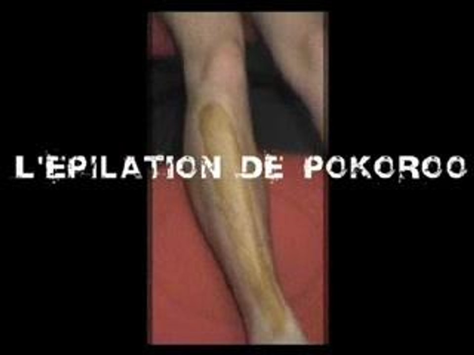 L'epilation pokoroo