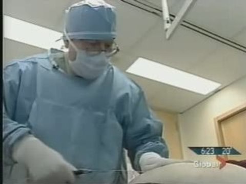 How Smart Laser Liposuction and Dr.Barry Lycka Can Help You