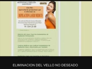 Depilacion por laser