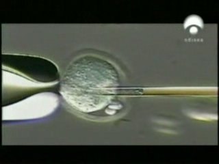 Lesion medular: Celulas madre