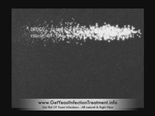 Natural Tips to Cure a Yeast Infection