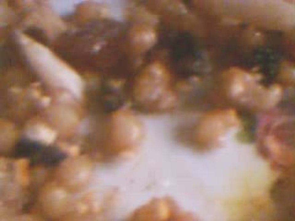 anakatema