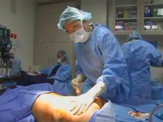 Fat Transfer from Midsection to Buttocks - Dr. David E Kim