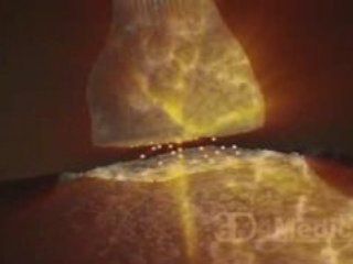 Test Storyboard Intro