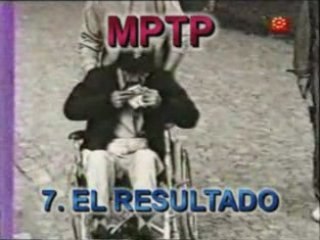 Pet cerebro post-transplante en enfermedad de Parkinson