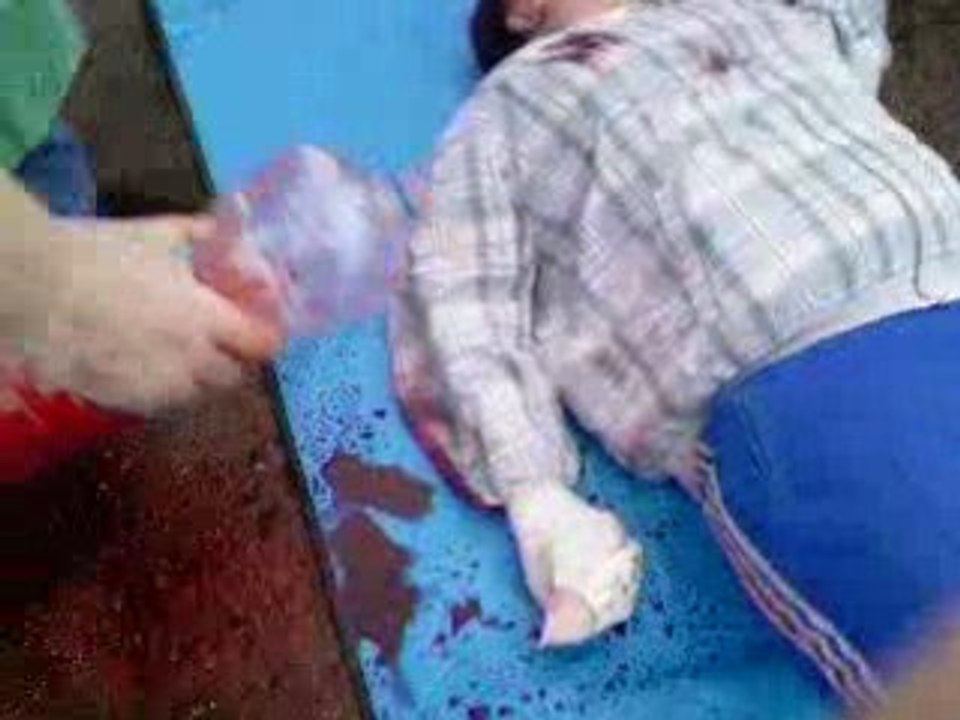 PSE1 cas concret 1 bis