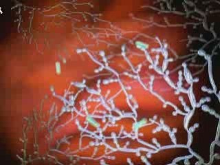 Get rid of yeast infection