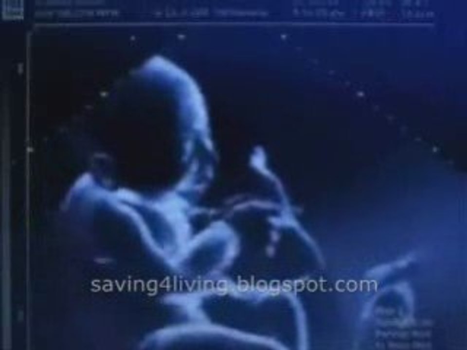 Twins Problem - Funny
