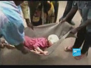 Albinos tracked down in lucrative trade of body parts