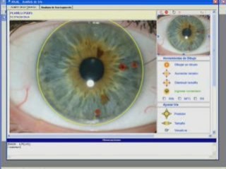 Software de Iridologia