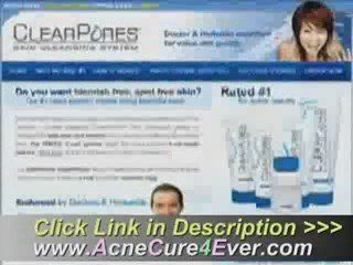 How to Cure Acne Fast